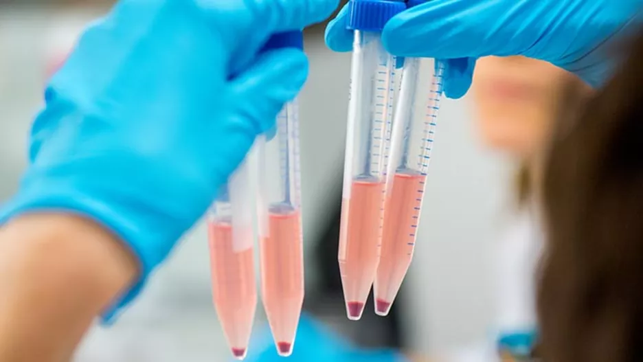 Reagenzgläser mit zu untersuchender Flüssigkeit Eine Labormitarbeiterin hält Zentrifugenröhrchen mit Zellsuspensionen hoch und analysiert diese analysiert werden_Foto: Andreas Heddergott / TUM